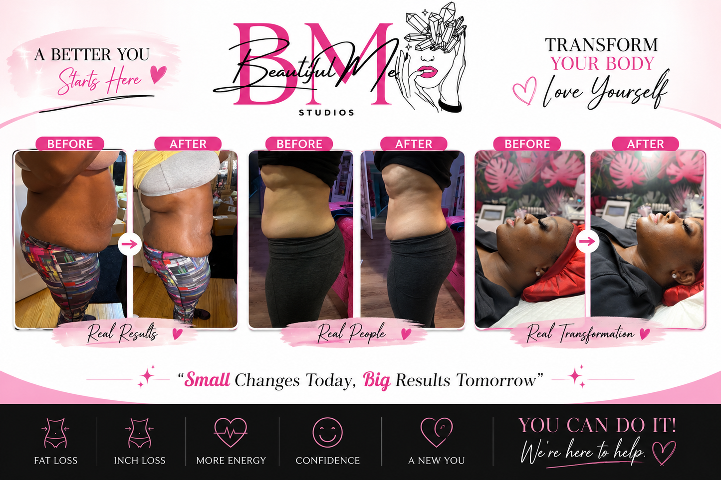 Fat Sculpting Treatment Stomach